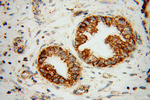 B3GALT4 Antibody in Immunohistochemistry (Paraffin) (IHC (P))