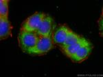 SNX16 Antibody in Immunocytochemistry (ICC/IF)