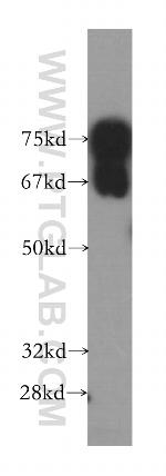 RUFY1 Antibody in Western Blot (WB)