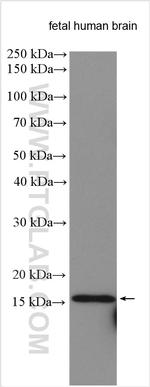 NGB Antibody in Western Blot (WB)