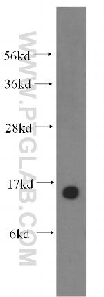 NGB Antibody in Western Blot (WB)