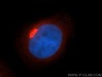 p115/USO1 Antibody in Immunocytochemistry (ICC/IF)