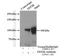 EEF2K Antibody in Immunoprecipitation (IP)