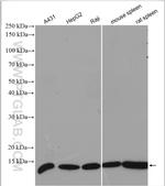 Beta-2-microglobulin Antibody in Western Blot (WB)
