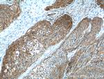 Beta-2-microglobulin Antibody in Immunohistochemistry (Paraffin) (IHC (P))