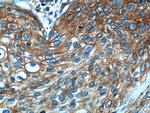 Beta-2-microglobulin Antibody in Immunohistochemistry (Paraffin) (IHC (P))