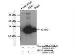 Beta-2-microglobulin Antibody in Immunoprecipitation (IP)