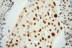 SNRPB2 Antibody in Immunohistochemistry (Paraffin) (IHC (P))