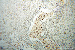 SNRPB2 Antibody in Immunohistochemistry (Paraffin) (IHC (P))