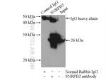 SNRPB2 Antibody in Immunoprecipitation (IP)