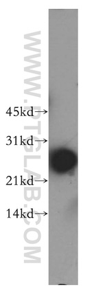 SNRPB2 Antibody in Western Blot (WB)