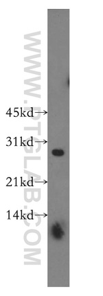 SNRPB2 Antibody in Western Blot (WB)