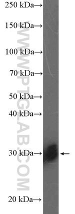 SNRPB2 Antibody in Western Blot (WB)