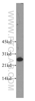 SNRPB2 Antibody in Western Blot (WB)