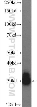 SNRPB2 Antibody in Western Blot (WB)