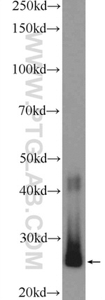 SNRPB2 Antibody in Western Blot (WB)