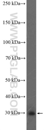 SNRPB2 Antibody in Western Blot (WB)