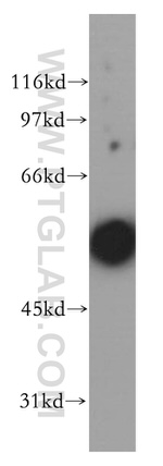 CHRNA5 Antibody in Western Blot (WB)