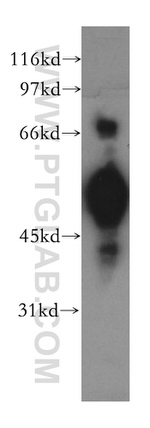 CHRNA5 Antibody in Western Blot (WB)