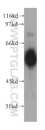 CHRNA5 Antibody in Western Blot (WB)