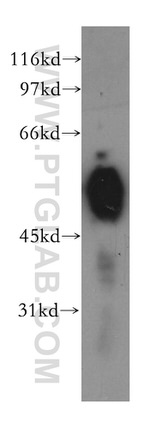 CHRNA5 Antibody in Western Blot (WB)