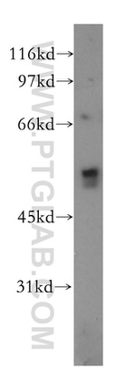 CHRNA5 Antibody in Western Blot (WB)
