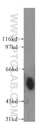 TEKT2 Antibody in Western Blot (WB)