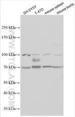 Glypican 2 Antibody in Western Blot (WB)