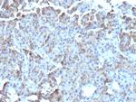 CD109 Monoclonal Antibody (CD109/9947)