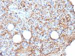 CD109 Monoclonal Antibody (CD109/9949)