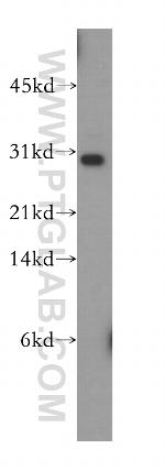 TRBV5-4 Antibody in Western Blot (WB)