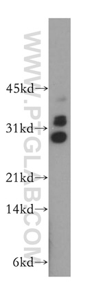 TRBV5-4 Antibody in Western Blot (WB)
