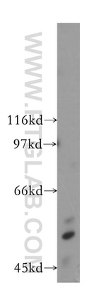 ZnT6 Antibody in Western Blot (WB)