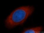 EIF5B Antibody in Immunocytochemistry (ICC/IF)