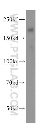 Nidogen 2 Antibody in Western Blot (WB)