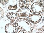 Proenkephalin-A Antibody in Immunohistochemistry (Paraffin) (IHC (P))