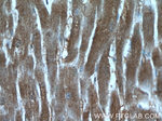 HMGCR Antibody in Immunohistochemistry (Paraffin) (IHC (P))