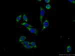 FSCN3 Antibody in Immunocytochemistry (ICC/IF)