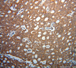 FSCN3 Antibody in Immunohistochemistry (Paraffin) (IHC (P))