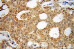 FSCN3 Antibody in Immunohistochemistry (Paraffin) (IHC (P))