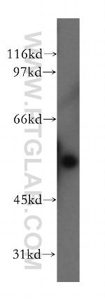 FSCN3 Antibody in Western Blot (WB)