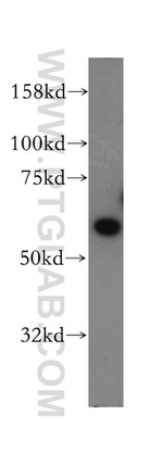 PAK6 Antibody in Western Blot (WB)