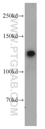 FUK Antibody in Western Blot (WB)