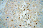 CROT Antibody in Immunohistochemistry (Paraffin) (IHC (P))