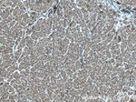 PDSS2 Antibody in Immunohistochemistry (Paraffin) (IHC (P))
