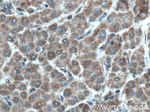 PDSS2 Antibody in Immunohistochemistry (Paraffin) (IHC (P))