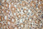 PDSS2 Antibody in Immunohistochemistry (Paraffin) (IHC (P))