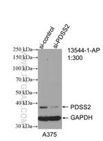 PDSS2 Antibody in Western Blot (WB)