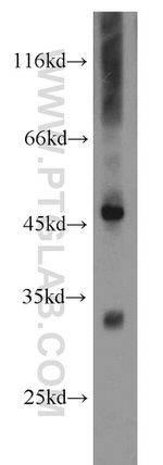 PDSS2 Antibody in Western Blot (WB)