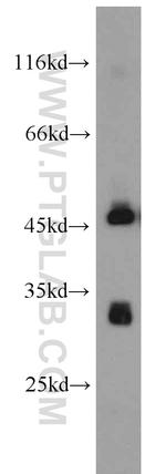 PDSS2 Antibody in Western Blot (WB)